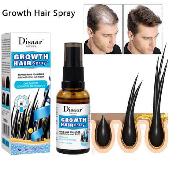 Ginseng Root Hair Growth Spray — Anti Hair Loss | Vegan | Leave-In Treatment | 30ml