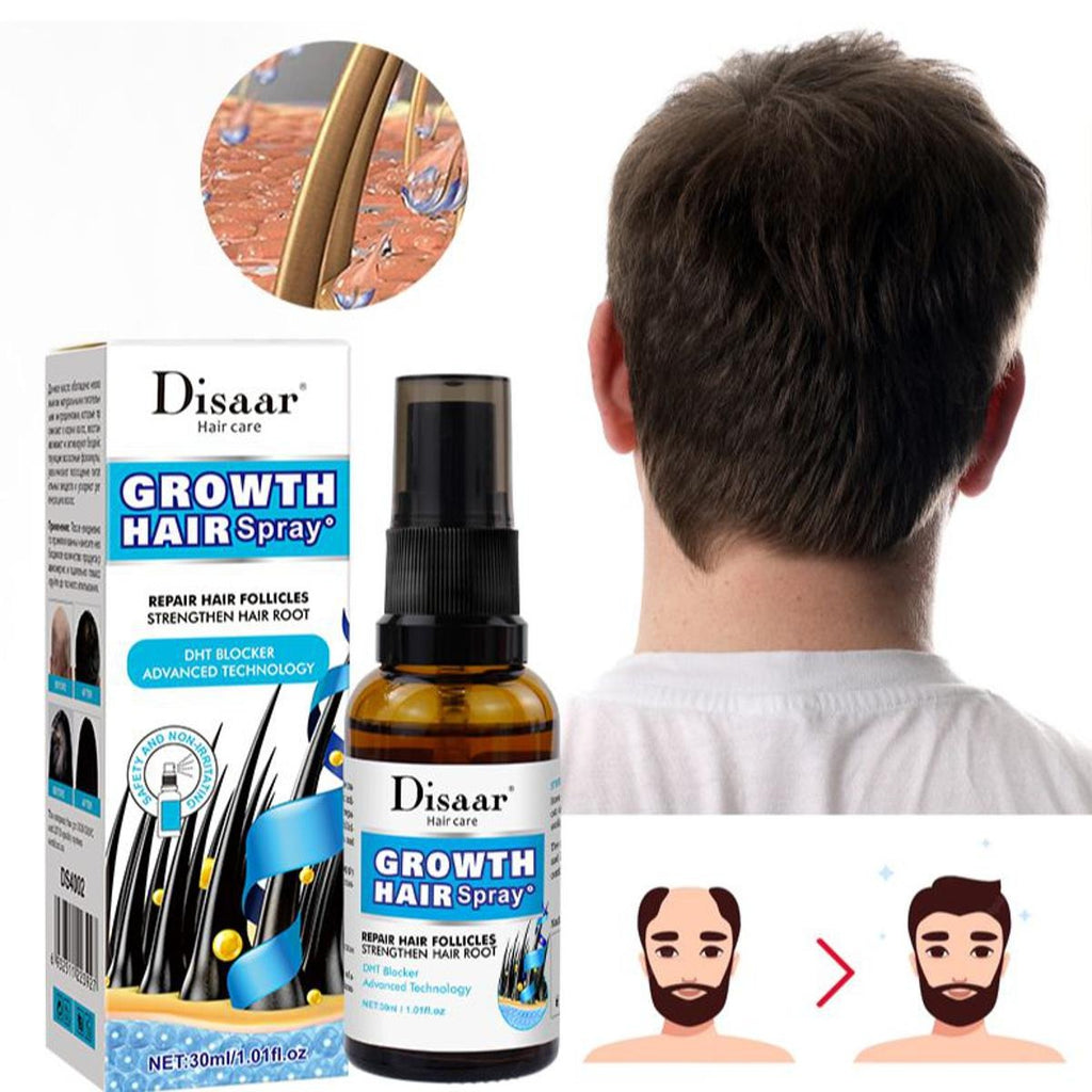 Ginseng Root Hair Growth Spray — Anti Hair Loss | Vegan | Leave-In Treatment | 30ml