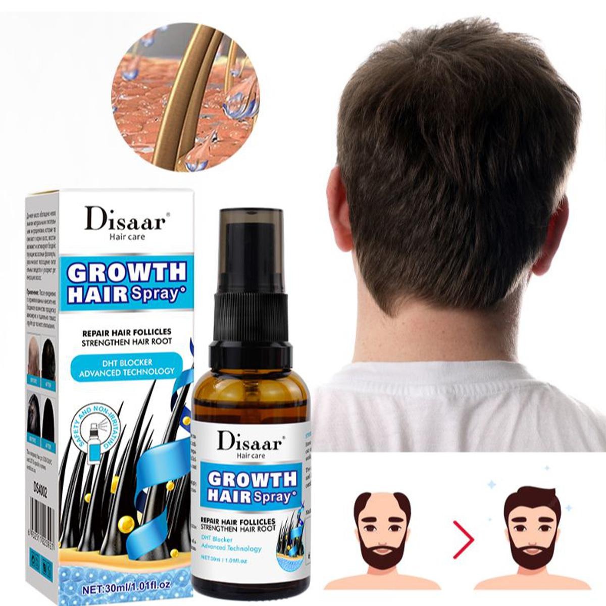 Ginseng Root Hair Growth Spray — Anti Hair Loss | Vegan | Leave-In Treatment | 30ml