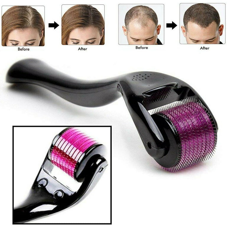 Derma Roller 0.5mm — Hair Growth & Skin Renewal Tool