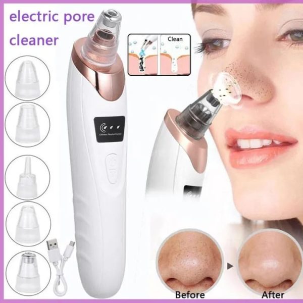 Blackhead Vacuum Remover — 5-Head Electric Pore Cleaner & Skin Exfoliator