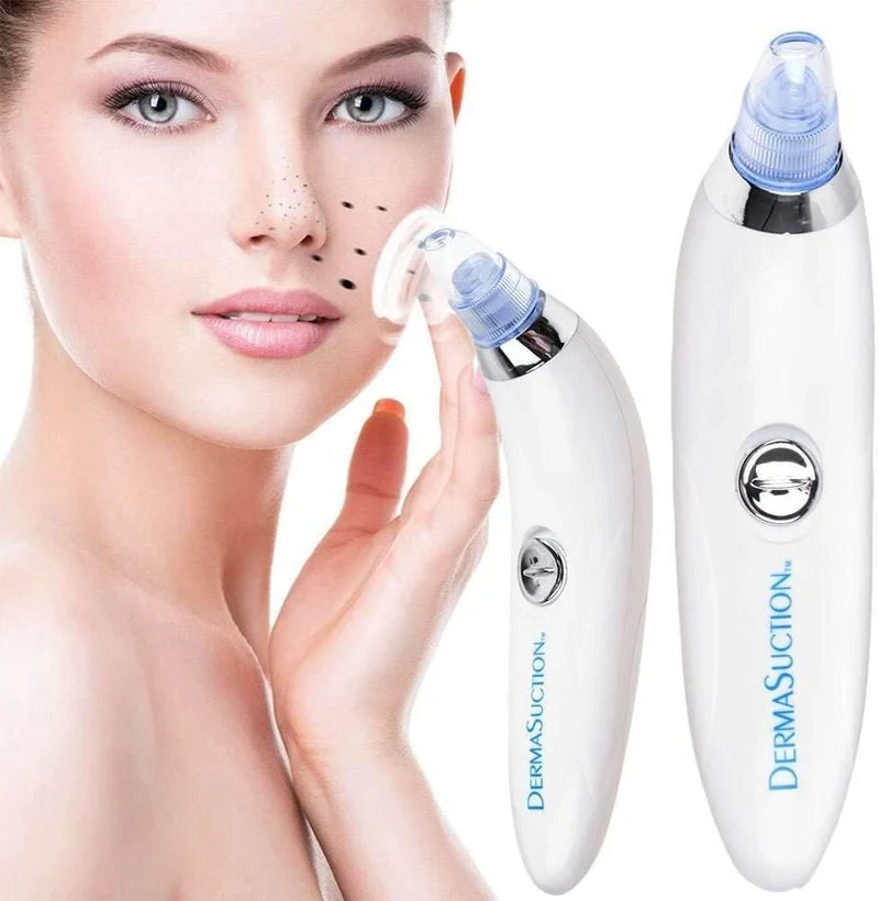 White handheld pore cleaning vacuum with blue suction head